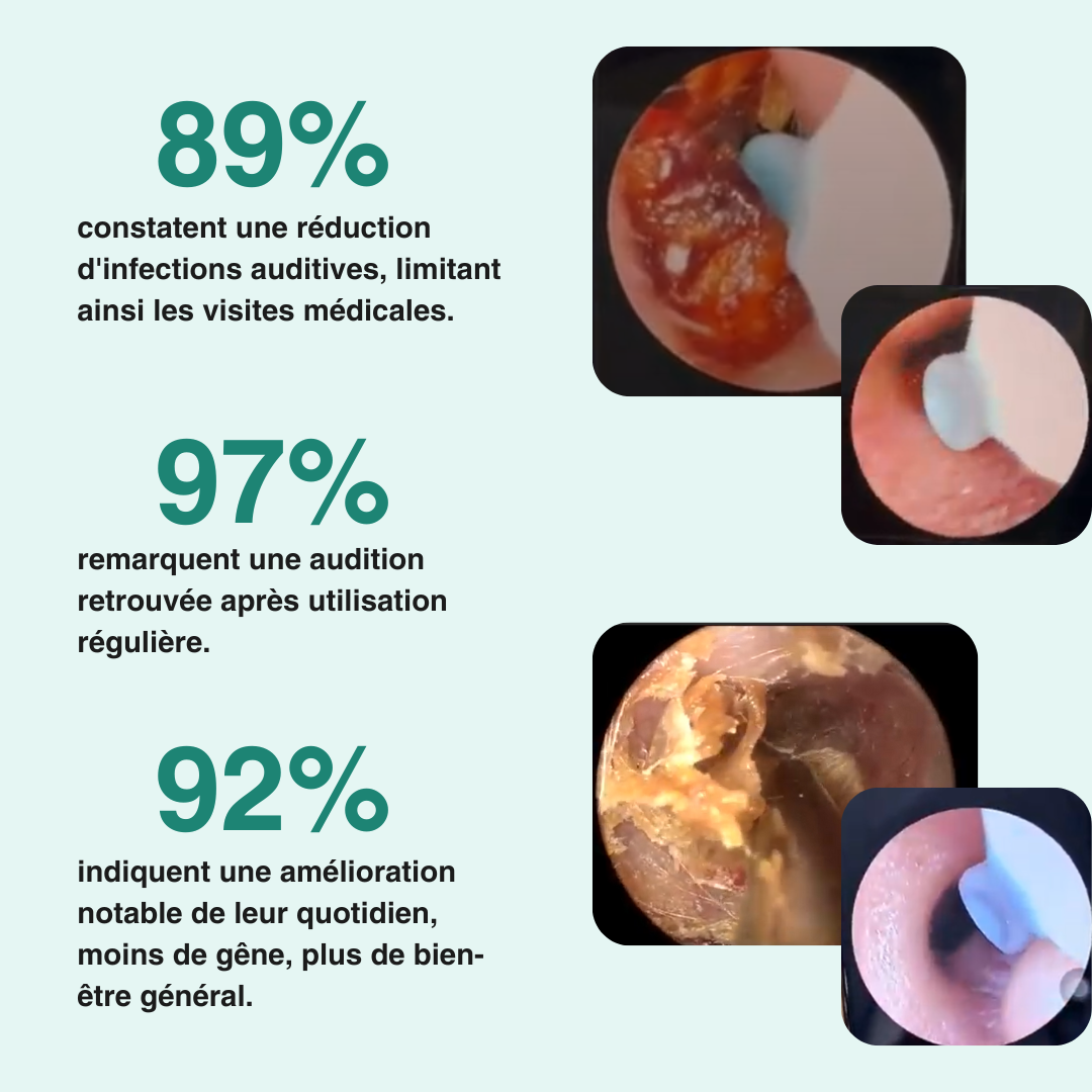 Nettoyeur d'oreilles à vision assistée